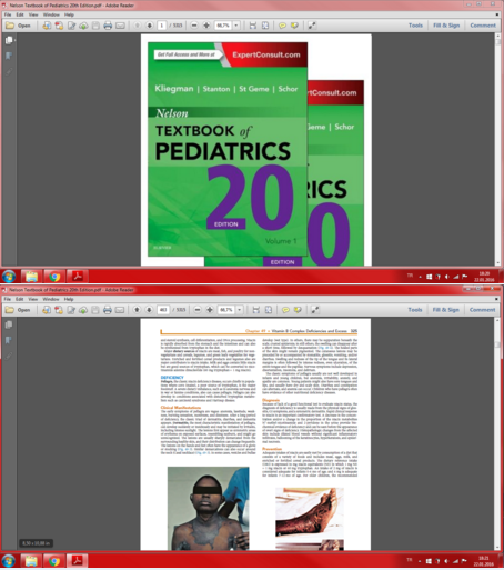 nelson textbook of pediatrics  pdf