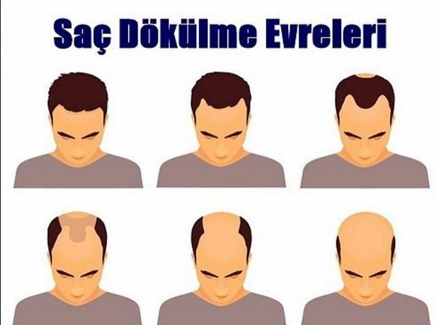 7NOOVl.jpg