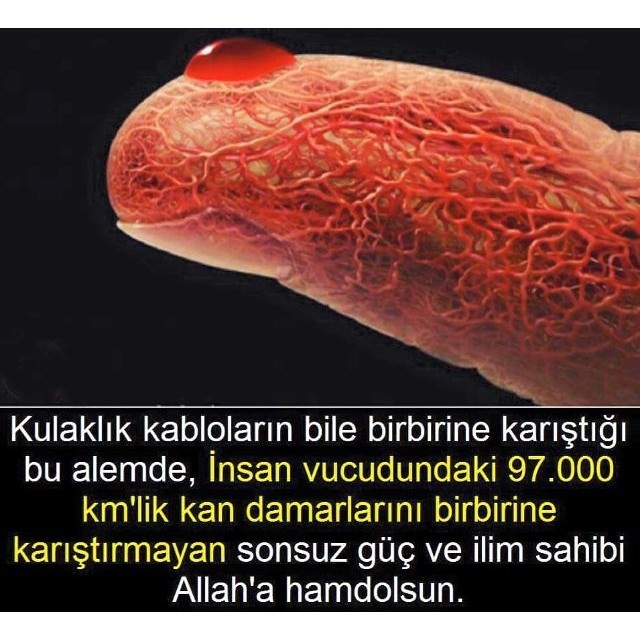 [Resim: RPvV5G.jpg]