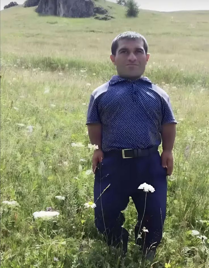 eylobe2.jpg