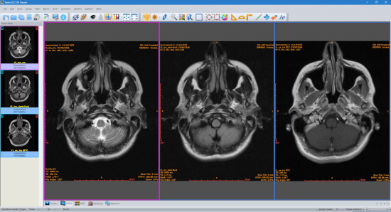 Sante DICOM Viewer Pro 12.2.8 download the new version for mac