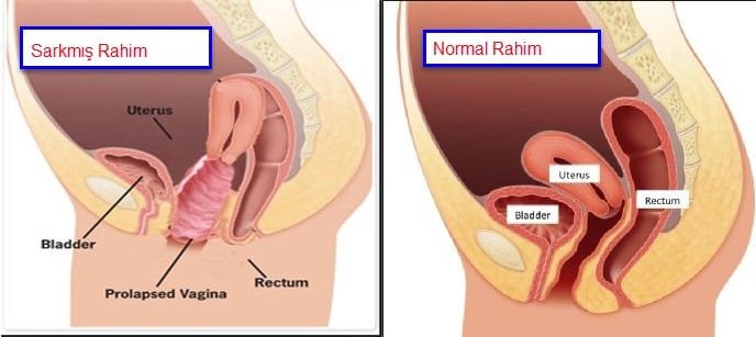 r07Nqm.jpg